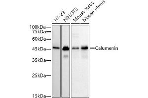 Western blot analysis of extracts of various cell lines, using (ABIN7266050) at 1:500 dilution. (CALU anticorps)