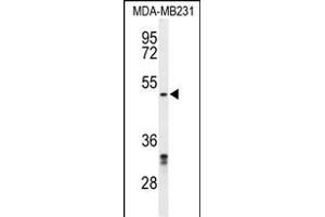 Western blot analysis of CBX2 Antibody (N-term) (ABIN653558 and ABIN2842937) in MDA-M cell line lysates (35 μg/lane). (CBX2 anticorps  (N-Term))