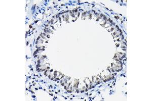 Immunohistochemistry of paraffin-embedded rat lung using SSN Rabbit pAb (3377) at dilution of 1:100 (40x lens). (SSNA1 anticorps  (AA 1-119))