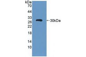 Detection of Recombinant ABCC3, Human using Polyclonal Antibody to ATP Binding Cassette Transporter C3 (ABCC3) (ABCC3 anticorps  (AA 1291-1523))