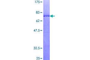 Image no. 1 for Mitogen-Activated Protein Kinase-Activated Protein Kinase 2 (MAPKAPK2) (AA 1-400) protein (GST tag) (ABIN1310322)