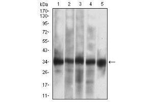 Western blot analysis using CASP-7 mouse mAb against Jurkat (1), HEK293 (2), MOLT4 (3), MCF-7 (4), PC-12 (5) cell lysate.