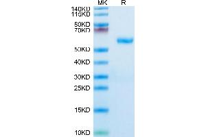 Human RNF43 on Tris-Bis PAGE under reduced condition. (RNF34 Protein (AA 24-197) (Fc Tag))