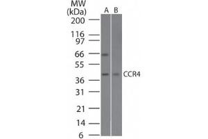 Image no. 1 for anti-Chemokine (C-C Motif) Receptor 4 (CCR4) (AA 337-351) antibody (ABIN1100490) (CCR4 anticorps  (AA 337-351))