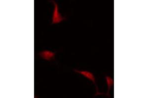 ABIN6266862 staining COLO205 by IF/ICC. (MAPKAP Kinase 3 anticorps  (C-Term))