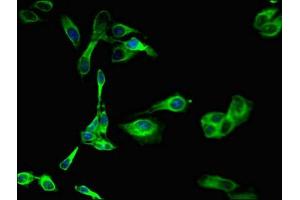 Immunofluorescent analysis of Hela cells using ABIN7169176 at dilution of 1:100 and Alexa Fluor 488-congugated AffiniPure Goat Anti-Rabbit IgG(H+L) (SGK1 anticorps  (AA 247-406))