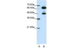 WB Suggested Anti-SNRP70  Antibody Titration: 0. (SNRNP70 anticorps  (C-Term))