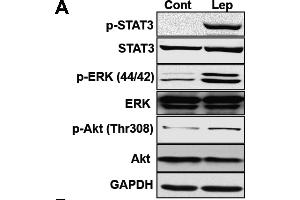 Leptin activated STAT3, ERK, and Akt in SH-SY5Y-ObRb cells.