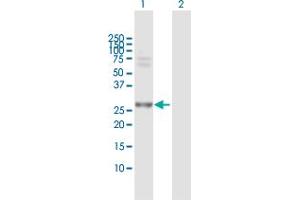 Western Blot analysis of PSMA7 expression in transfected 293T cell line by PSMA7 MaxPab polyclonal antibody.