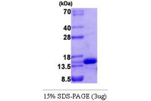 SDS-PAGE (SDS) image for Vascular Endothelial Cell Growth Factor 121 (VEGF121) (Isoform 121) protein (ABIN667096) (VEGF121 Protein (Isoform 121))