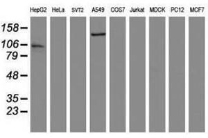 Image no. 2 for anti-ATP/GTP Binding Protein 1 (AGTPBP1) (AA 368-753) antibody (ABIN1491462) (AGTPBP1 anticorps  (AA 368-753))