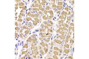 Immunohistochemistry of paraffin-embedded Human gastric using RAMP1 antibody at dilution of 1:100 (x400 lens). (RAMP1 anticorps)