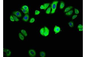 Immunofluorescence staining of HepG2 cells with  at 1:133, counter-stained with DAPI. (GAB1 anticorps  (AA 119-329))