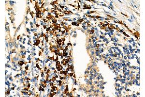 anti-Kinesin Family Member 4A (KIF4A) (C-Term) antibody