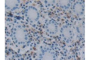 Detection of NOS1AP in Human Stomach Tissue using Polyclonal Antibody to Nitric Oxide Synthase 1 Adaptor Protein (NOS1AP) (NOS1AP anticorps  (AA 285-506))