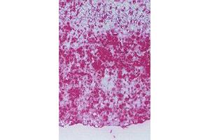 Detection of HEL at Human atherosclerotic lesions. (N epsilon Hexanoyl-Keyhole Limpet Hemocyanin (HEL-KLH) anticorps)