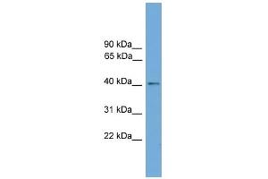 WB Suggested Anti-ZDHHC18 Antibody Titration:  0. (ZDHHC18 anticorps  (Middle Region))
