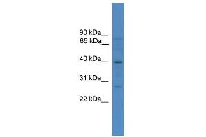 WB Suggested Anti-SOX1 Antibody Titration:  0.