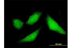 Immunofluorescence of purified MaxPab antibody to CPXCR1 on HeLa cell. (CPXCR1 anticorps  (AA 1-301))