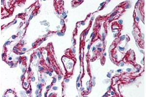 Human Lung (formalin-fixed, paraffin-embedded) stained with Collagen VI antibody ABIN364508 at 2. (COL6 anticorps)