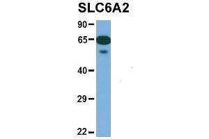 Host:  Rabbit  Target Name:  SLC6A2  Sample Type:  Human Fetal Heart  Antibody Dilution:  1.