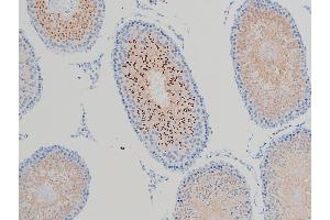 ABIN6267443 at 1/100 staining rat testicular tissue sections by IHC-P.