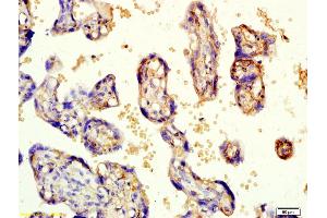 Formalin-fixed and paraffin embedded human placenta labeled with Rabbit Anti-KCNK3 Polyclonal Antibody, Unconjugated (ABIN682333) at 1:200 followed by conjugation to the secondary antibody and DAB staining (KCNK3 anticorps  (AA 181-280))