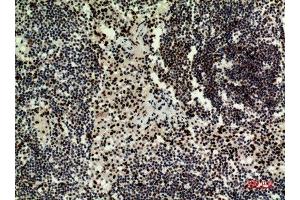 Immunohistochemistry (IHC) analysis of paraffin-embedded Human Lymph Nodes, antibody was diluted at 1:100. (HDGFRP3 anticorps  (Internal Region))