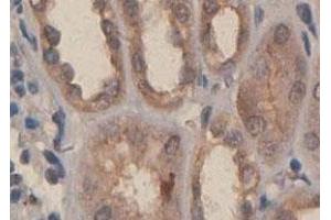 Immunohistochemical staining of formalin-fixed paraffin-embedded human fetal kidney tissue with PDGFC polyclonal antibody  at 1 : 100 dilution. (PDGFC anticorps  (C-Term))