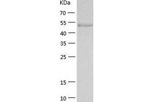Western Blotting (WB) image for Muscle, Skeletal, Receptor Tyrosine Kinase (MUSK) (AA 22-468) protein (His-IF2DI Tag) (ABIN7124032)