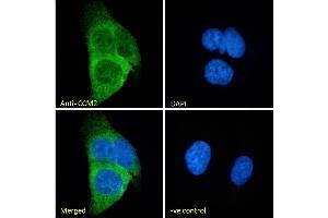 (ABIN185733) Immunofluorescence analysis of paraformaldehyde fixed U2OS cells, permeabilized with 0.
