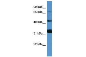 WB Suggested Anti-MFI2 Antibody Titration: 0. (MFI2 anticorps  (C-Term))