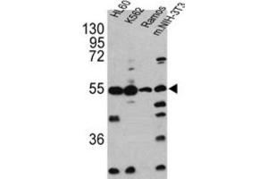 Western Blotting (WB) image for anti-Caspase 2, Apoptosis-Related Cysteine Peptidase (CASP2) antibody (ABIN2997249) (Caspase 2 anticorps)
