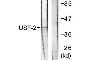 Western blot analysis of extracts from HeLa cells, using USF2 antibody. (USF2 anticorps  (Internal Region))