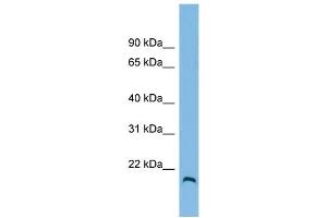 WB Suggested Anti-HFE2 Antibody Titration: 0. (HFE2 anticorps  (N-Term))