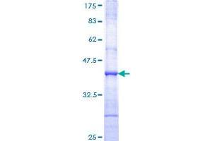 Image no. 1 for Son of Sevenless Homolog 2 (SOS2) (AA 312-420) protein (GST tag) (ABIN1320975)