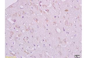 Formalin-fixed and paraffin embedded mouse kidney tissue labeled with Anti CRHR2/Corticotropin Releasing Factor Receptor 2 Polyclonal Antibody, Unconjugated (ABIN680773) at 1:200 followed by conjugation to the secondary antibody and DAB staining