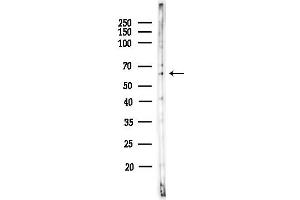 Western blot analysis of lysates from HepG2 cells(heat-shock,45 min treatment), using UG Antibody at 1/1000 dilution.