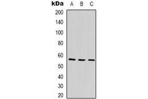 Western blot analysis of ANGPTL1 expression in Jurkat (A), MCF7 (B), K562 (C) whole cell lysates. (ANGPTL1 anticorps)