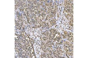 IHC analysis of SART1 using anti-SART1 antibody (ABIN7599884).