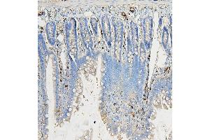 IHC analysis of COPE using anti-COPE antibody (ABIN7602509). (COPE anticorps  (AA 80-308))