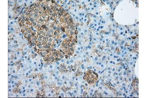 Immunohistochemical staining of paraffin-embedded liver tissue using anti-ALDH3A1 mouse monoclonal antibody. (ALDH3A1 anticorps)