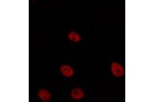 ABIN6275635 staining HepG2 by IF/ICC. (TCEAL6 anticorps)