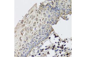 Immunohistochemistry of paraffin-embedded human esophagus using GBF1 antibody.