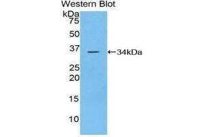 Western Blotting (WB) image for anti-Protein tyrosine Phosphatase, Receptor Type, J (PTPRJ) (AA 567-842) antibody (ABIN3206457) (PTPRJ anticorps  (AA 567-842))