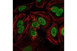 Immunofluorescence analysis of Hela cells using PRKDC mouse mAb (green). (PRKDC anticorps)