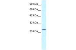 Western Blotting (WB) image for anti-Zinc Finger, AN1-Type Domain 6 (ZFAND6) antibody (ABIN2460960)