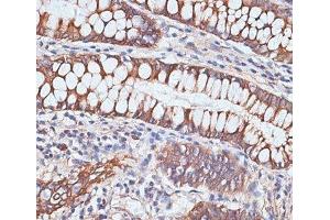 Immunohistochemistry of paraffin-embedded Human colon using PIGR Polyclonal Antibody at dilution of 1:100 (40x lens). (PIGR anticorps)