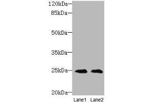 Western blot All lanes: TIMP3 antibody at 2 μg/mL Lane 1: EC109 whole cell lysate Lane 2: 293T whole cell lysate Secondary Goat polyclonal to rabbit IgG at 1/10000 dilution Predicted band size: 25 kDa Observed band size: 25 kDa (TIMP3 anticorps  (AA 30-208))