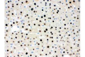 Immunohistochemistry (Paraffin-embedded Sections) (IHC (p)) image for anti-Retinoblastoma Binding Protein 4 (RBBP4) (AA 395-425), (C-Term) antibody (ABIN3043920)